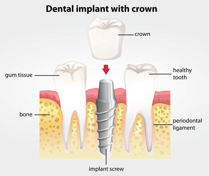 dentistry_care